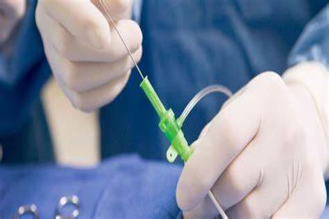 导尿操作示例图