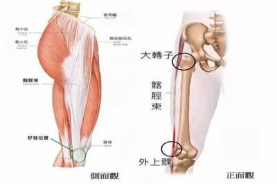 髂胫束位置图片