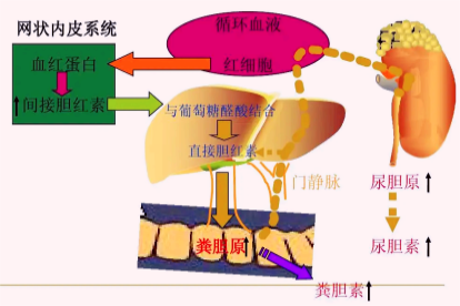 溶血性黄疸发生机制示意图