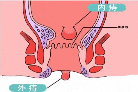 齿状线位置图片