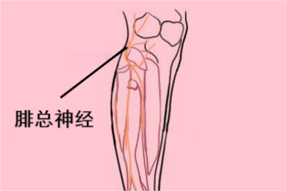 腓总神经损伤小腿肌肉肌力图