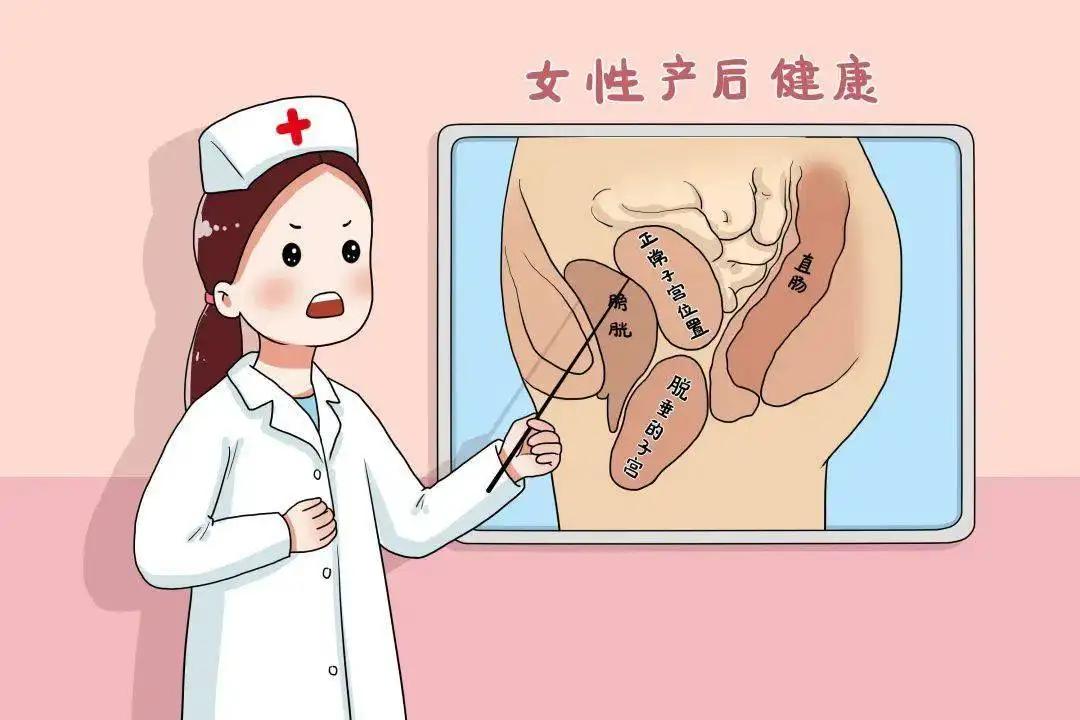 产后膨出图片