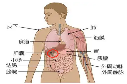 人体胆囊位置示意图
