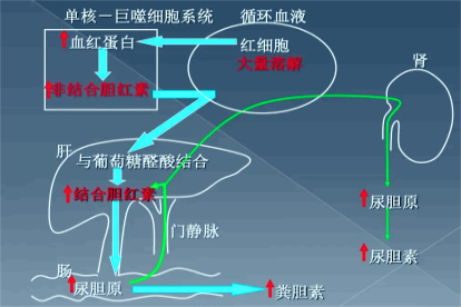 溶血性黄疸发生机制示意图