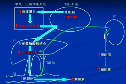 溶血性黄疸发生机制示意图