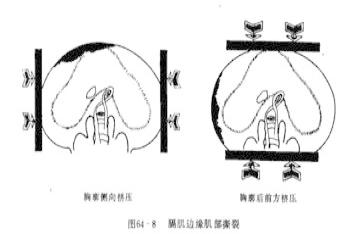 膈肌解剖图详细图