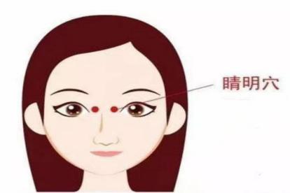 睛明穴位置图片