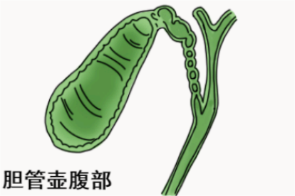 胆管壶腹部解剖图