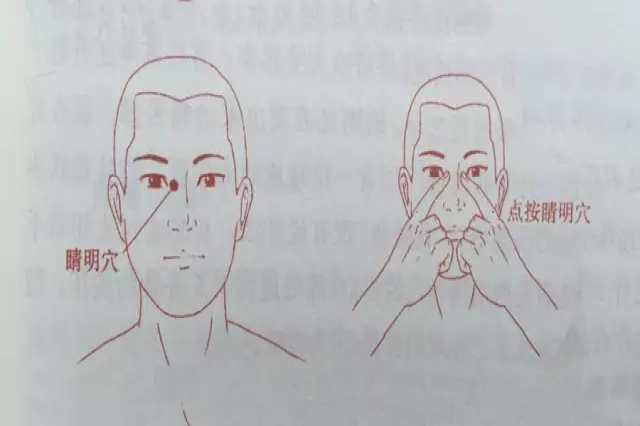 睛明穴位置图片