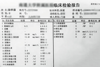 正常的尿沉渣报告单图