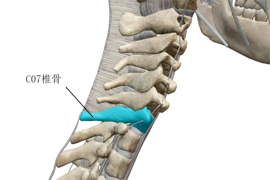 第七颈椎位置图片