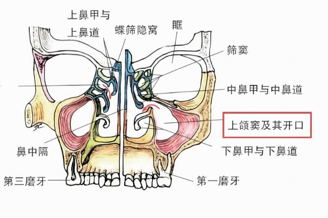 上颌窦解剖示意图