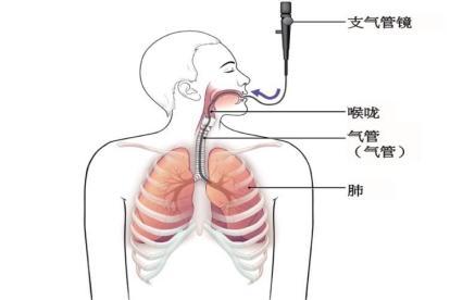 气管位置示意图片