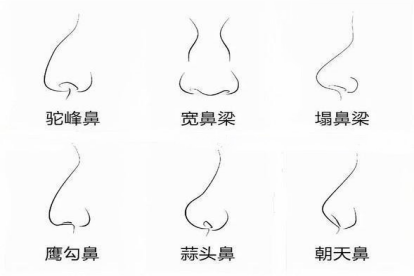 鼻子的鼻型图片