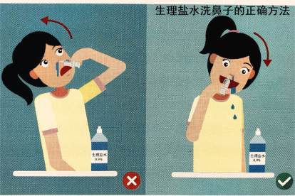 生理盐水洗鼻子的正确方法图解