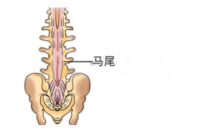 脊髓马尾位置示意图