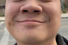 平实鼻图片
