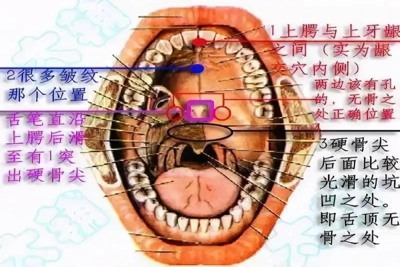 下颌小舌位置图片
