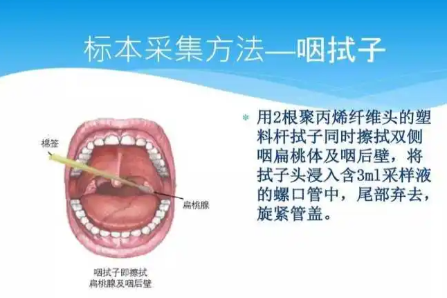 吞咽反射检查方法示意图