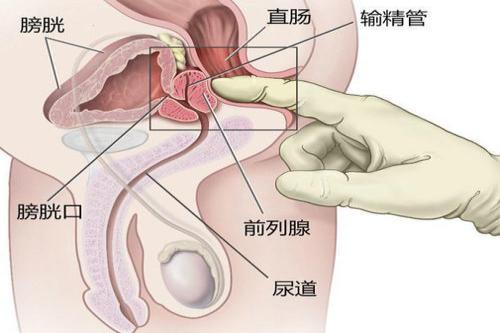 前列腺按摩图片