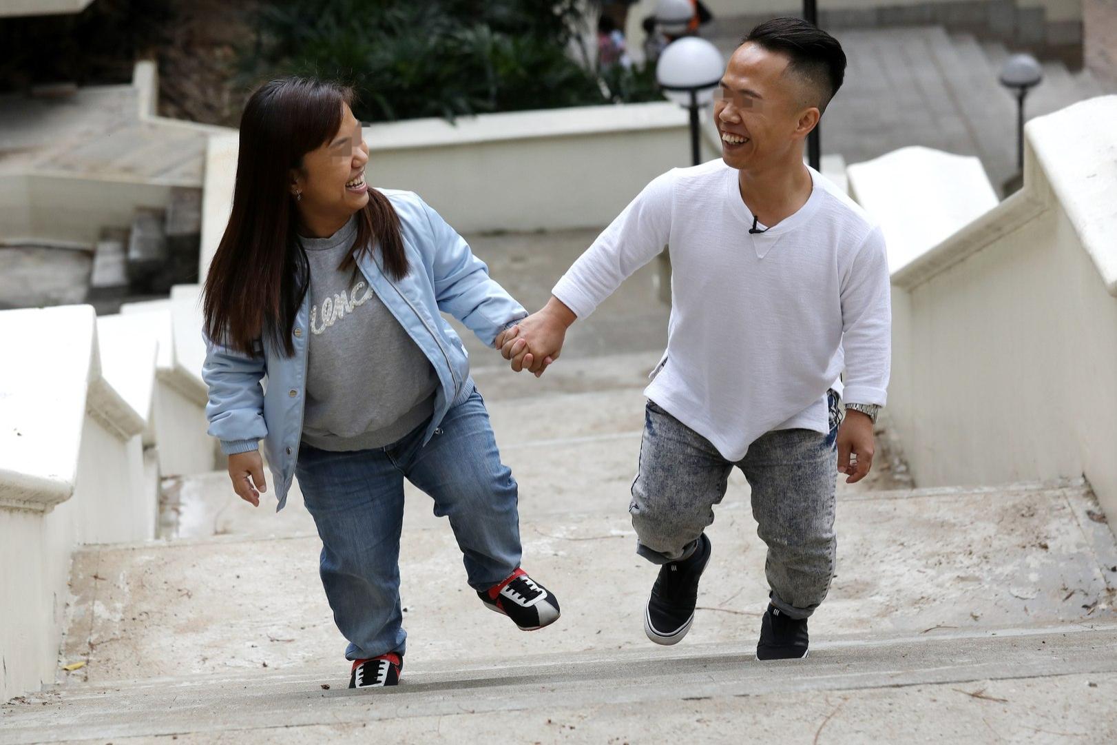 德朗热综合症患者图片