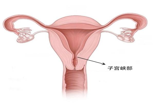 子宫峡部图片