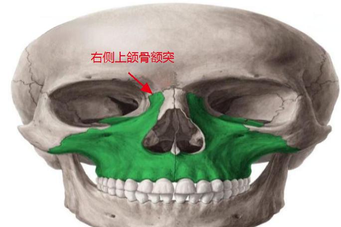 右侧上颌骨额突位置图片