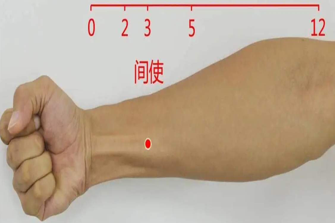 腕掌侧远端横纹的位置图