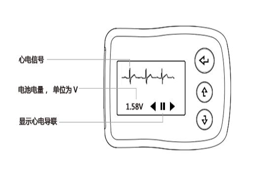 动态心电图示意图