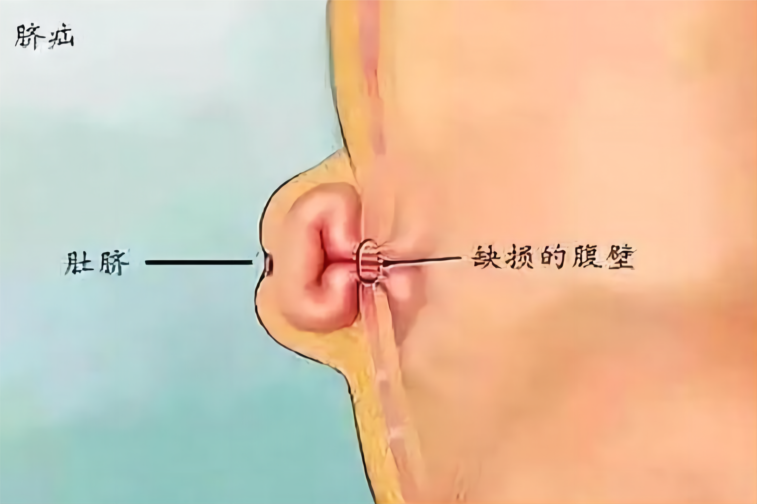 肚脐内部结构解剖图片