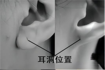 耳洞位置分析图片