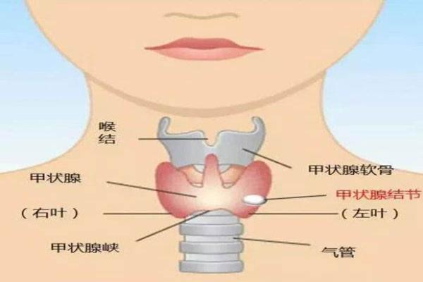 甲状腺峡部在哪个位置图片