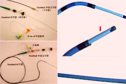 介入导管分类及功能图解