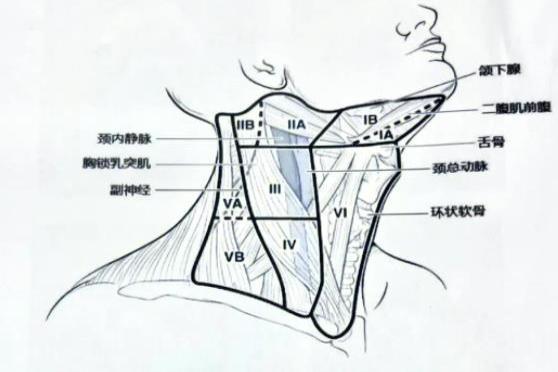 颈部淋巴结分区图片