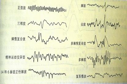 四种波形图片