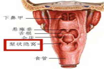 梨状隐窝图片