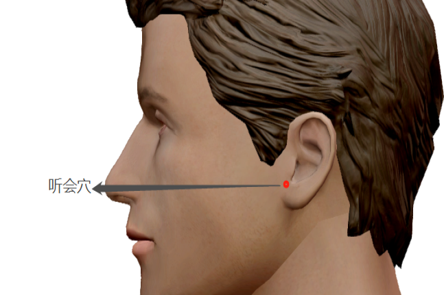 听会穴位置图片